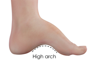 Foot & Ankle Deformity Correction
